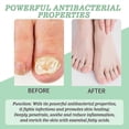 thumbnail image 2 of 20ML Nutraboost Nail Fungus Treatment Gel, Natural Nail Repair Strengthening Gel 1/3/5x, 2 of 5
