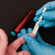thumbnail image 3 of Pluma De Punción De Sangre, Dispositivo De Punción Con Puntos De Presión Elevados Para Controlar El Azúcar En Sangre, 3 of 7