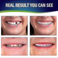 thumbnail image 3 of Juego de Dentaduras Postizas yuxing Superior e Inferior Comodidad Natural, 3 of 3
