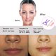thumbnail image 4 of 3pcs removedor de pelo de primavera depilación facial para mujeres depilatorio facial de primaver Irfora Removedor de pelo, 4 of 5