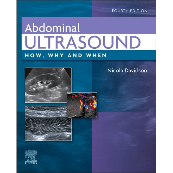 Abdominal Ultrasound