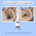 thumbnail image 2 of Hey Honey Skincare Be Clear - Tratamiento para manchas de acné durante la noche Loción para secar espinillas Uso sobre granos, puntos blancos y manchas 1 OZ, 2 of 5