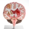 thumbnail image 4 of AMLESO Advanced Human Brain Cortex Pathology Model Anatomical Education Lab Display, 4 of 8