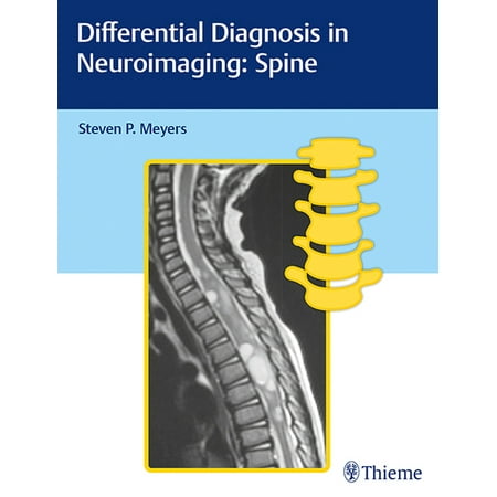 UPC: 9781626234772 | Differential Diagnosis in Neuroimaging: Spine (Hardcover)