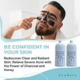 thumbnail image 3 of Ayadara Acne Face Wash with Charcoal & Sulfur, Cystic & Hormonal Acne Cleanser, 8 fl oz, 200 Uses, 3 of 11