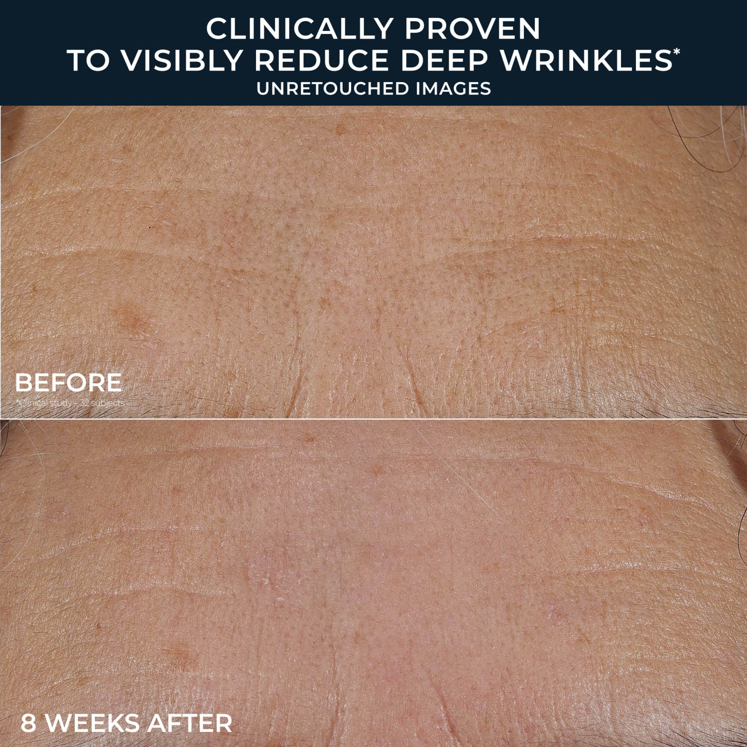 RoC Retinol Correction Deep Wrinkle Rich Cream photo 6
