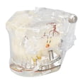 thumbnail image 1 of Herramienta de enseñanza clínica portátil para dientes propensos a enfermedades Modelo de implante dental acrílico transparente, 1 of 8