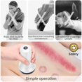 thumbnail image 2 of Electric suction cup-White, gua sha massager, cellublue massage anti-cellulite suction cup, promote blood circulation, Relax and relieve the body, leg, waist, back pain, 2 of 3