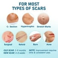 thumbnail image 5 of LotFancy Silicone Scar Sheets, 10 Silicone Scar Tape for C-Section, Keloid Bump, Burn, Acne,1.5 x 6in, 5 of 8