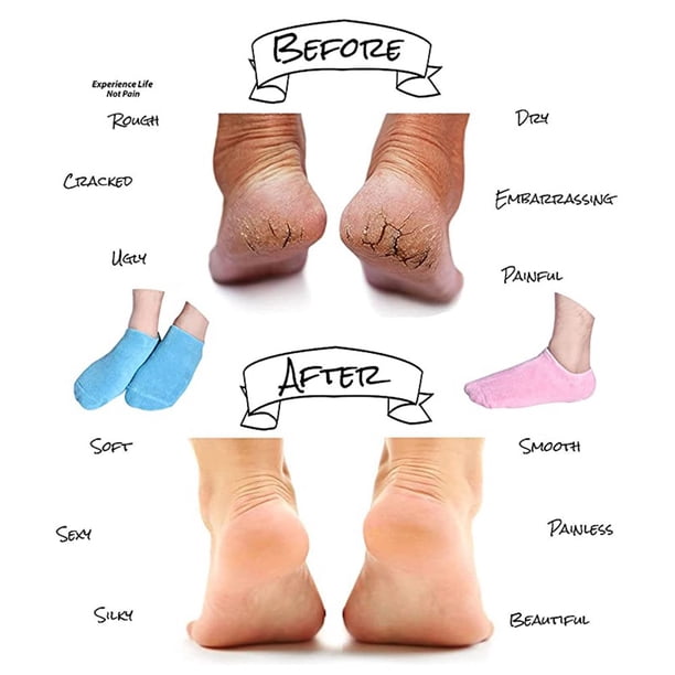 Lot 6 Paires Chaussettes Pilates Antidérapantes Femme – Grip Gel Silice Pour Yoga, Barre, Ballet, Hôpital