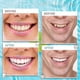 thumbnail image 3 of Carillas dentales, dentaduras postizas blancas para mandíbula superior e inferior, dientes falsos para mujeres y hombres, cómodo Flex Cosme, 3 of 5