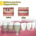 thumbnail image 4 of Propolis Gum Care Gel, Propolis Gum Gel, Propolis Teeth Regrowth Dental Gel, Gum Gel New Arrival, 4 of 5