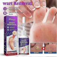 thumbnail image 3 of 2pcs Corn Removal Extra Strengthen Gel Foot Callus Removal Treatment Hard Skin, 3 of 3