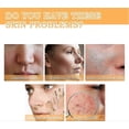 thumbnail image 2 of EELHOE Glycolic Acid 7% Toning Resurfacing Solution, Glycolic Sour 7% Toner Solution Toning Solution ph3.6 (100m, 2 of 5