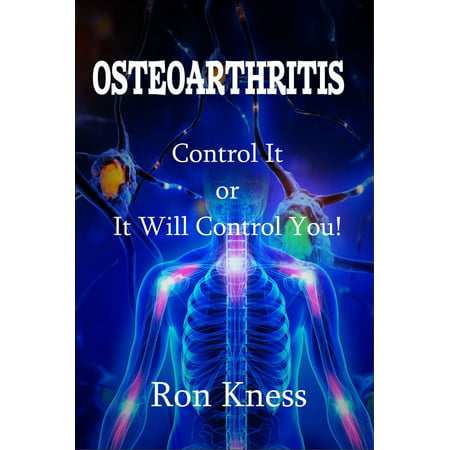 Osteoarthritis - eBook