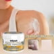 thumbnail image 2 of 3-5pcs Psoriasises Cream, Bee-venom Psoriasises Cream Skin Relief Anti-itch Cream Skin Care Products, 2 of 5