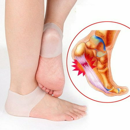 2pcs Silicone Moisturizing Socks Soften Gel Heel Cracked Plantar Fasciitis Foot Skin Care Protector Pedicure Pain (Best Remedy For Dry Cracked Heels)