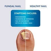 Pro Clearz Fungal Shield Brush-On Antifungal Liquid, Maximum Strength, 1 oz