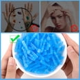 thumbnail image 4 of XIRQI Sterile Needles for Pimples,100Pcs Disposable Acne Lancet Effective Blemish And Blackhead Removal Tools for Clear Skin, 4 of 7
