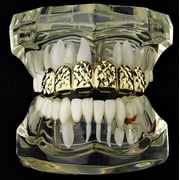 14k Gold Plated Grillz Diamond-Cut Bling Grill Top Upper Six 6 Teeth Hip Hop Mouth Grills