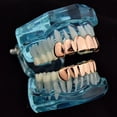 thumbnail image 3 of 14K Rose Gold Plated Grillz Set Upper Top And Bottom Lower Plain Teeth Hip Hop Grills, 3 of 5