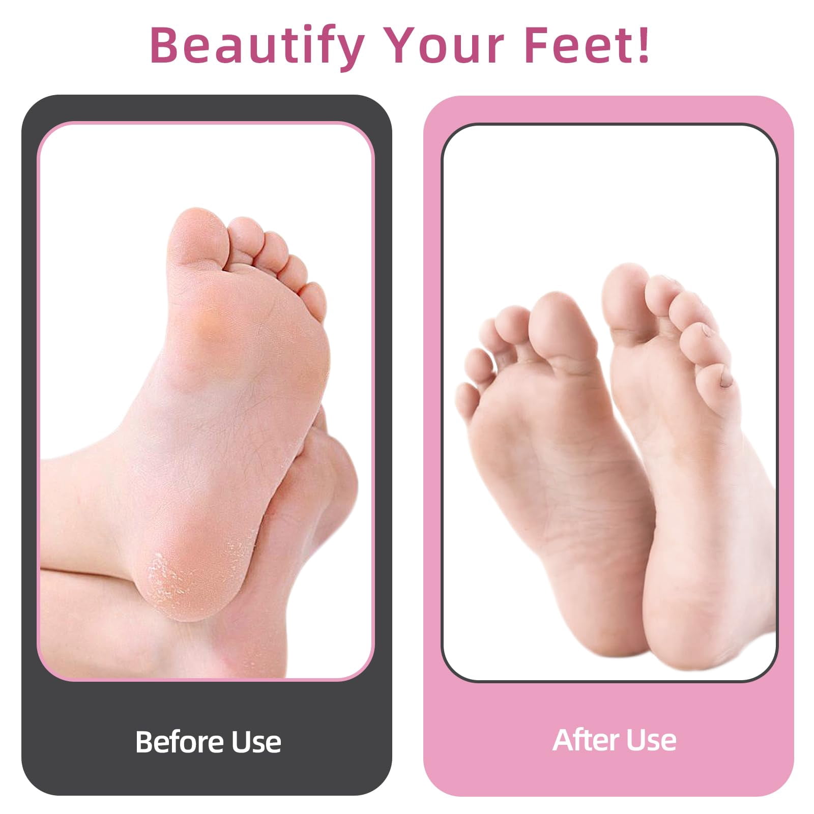 4.8IN Longer Electric Foot Callus Remover, Professional Aluminum Callus Remover for Feet with 80pcs Sandpaper Discs, Stepless Speed Control Pedicure Tools for Dead Skin Calluses (Rose Pink)