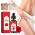 thumbnail image 1 of Fiudx Acetato Rosa, Nutritivo Profundo para La Piel, Repara La Sequedad y Retied Humedad, Absorbente Ligero, Brillo Delicado, Cuidado Corporal Diario, Rutina de La Piel para Mujeres, Fórmula de Larga, 1 of 7