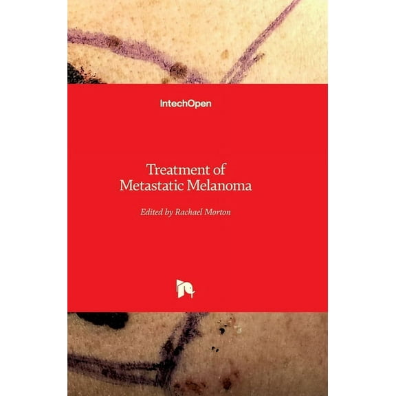 Treatment of Metastatic Melanoma (Hardcover)