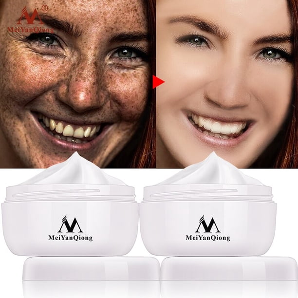 Mágico profundo limpia la piel de la cara descargada, plomo melanina a puntos negros, limpia ilumina los poros, encoge los poros, crema de masaje blanqueadora"50ml" Fivean LED