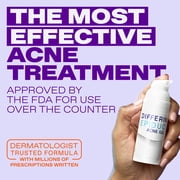 Differin Epiduo Pump 0.5oz with Adapalene 0.1% and Benzoyl Peroxide 2.5% Gel