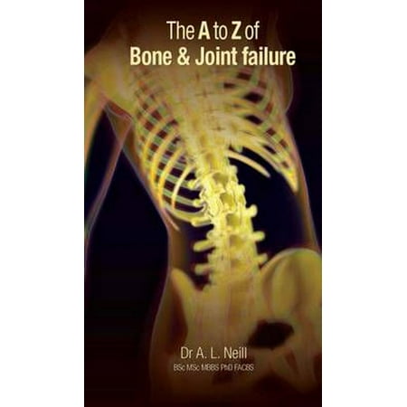 A To Z Of Bone Joint Failure - 