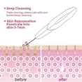 thumbnail image 4 of Vett Skin Scrubber for Face Scrub, Blackhead Remove Pore Cleaner Instrument, Ion Face, 4 of 5