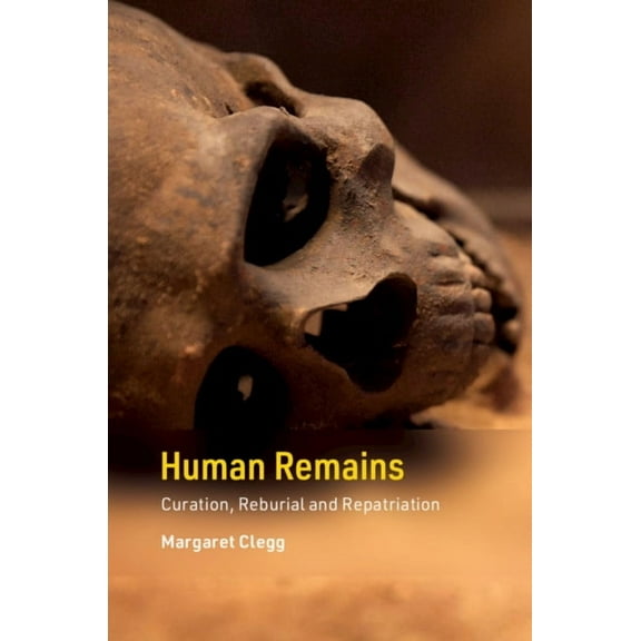 Cambridge Texts in Human Bioarchaeology Human Remains: Curation, Reburial and Repatriation, (Paperback)