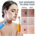 thumbnail image 4 of Skin-Tag Remover Double Headed Pen Set, Multi-Purpose 2 in 1 Design, Fast Effective Portable Convenient 2-9mm 2025 Hot, 4 of 5