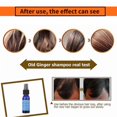 thumbnail image 2 of Essence réparatrice et nourrissante pour la repousse des cheveux, anti-chute, 30 ml, pour femmes et hommes, 2 of 4