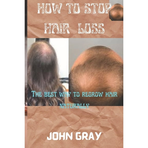 How to stop hair loss: The best way to regrow hair naturally (Paperback) by John Gray