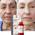 thumbnail image 3 of Suero facial reafirmante instantáneo para el cuidado de la piel, líquido antienvejecimiento para eliminar arrugas, Retinol, líneas finas, blanqueamiento, productos coreanos, 3 of 5
