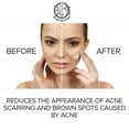 thumbnail image 4 of Anti Aging Corrector Cream, 4 of 7