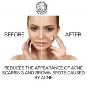 Anti Aging Corrector Cream