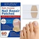 thumbnail image 2 of 3X Nail Treatment Patch Anti Fungal Nail Correction Stickers Ingrown Toenail Care Paronychia Anti Infection Repair Patch, 2 of 5