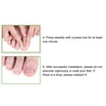 thumbnail image 4 of 10pcs Toenail  Strips Brace, Elastic Change Growth Direction Ingrown Toenail  Brace, 4 of 8