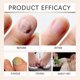 thumbnail image 4 of 3x Bee Venom Nail Repair Serum, Nail Care Solution, Natural Bee Venom Nail Care Spray, Ingrown Toenail Care Spray, 4 of 5