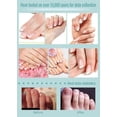 thumbnail image 3 of Fungal Nail Solution for Toenails - Fixes Discolored Nails, Safe & Effective - Anti Fungus Oil for Ingrown Toenails, 3 of 5