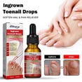 thumbnail image 2 of Barsinfi 30ML Ingrown Toenail Treatment,nail Growth Treatment,ingrown Toenail Drops Cuticle Nail Oil Ingrown Toenail Correction, 2 of 5