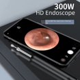 thumbnail image 4 of Endoscopio visual para destapar orejas, de alta definición, inteligente y luminoso, otoscopio para niños, herramienta para destapar orejas en casa, 4 of 6
