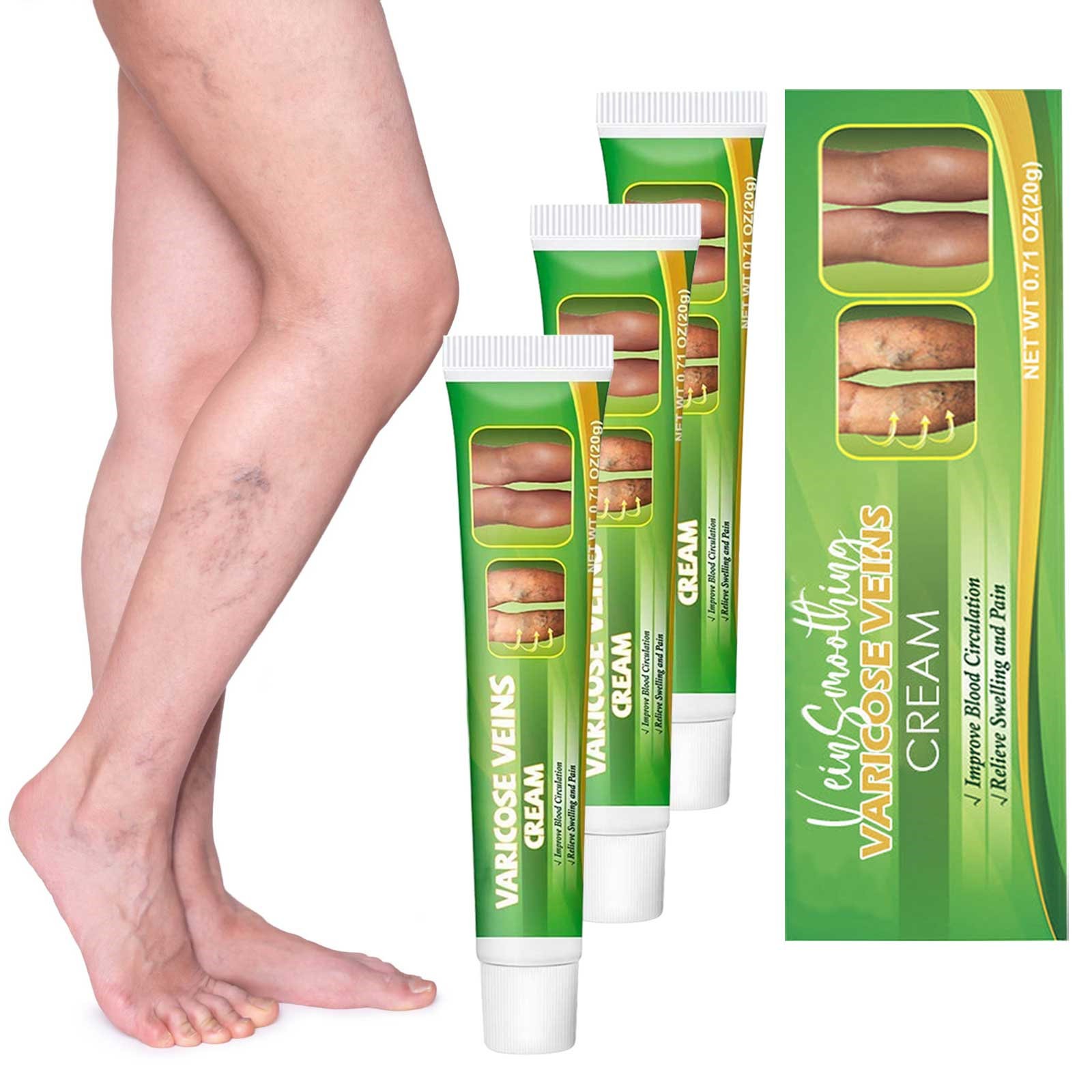 Vein Healings Creams Unclogs And Relieves Swollen Veins And Legs