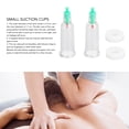 thumbnail image 3 of Finger Cupping Cups, Muscle Relaxing Cupping Vacuum Cups Heat Resistance  for Knuckles, 3 of 8