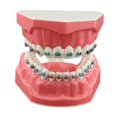 thumbnail image 1 of Dentalmall Typodonts Modelo de demostración de ortodoncia con alambres de metal y soporte Modelo de interpretación de enseñanza aprendizaje para adultos y niños (soporte de metal), 1 of 5