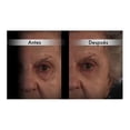 thumbnail image 3 of Lissé RBH Lisse, 3 of 4