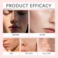 thumbnail image 2 of Crema hidratante facial hidratante y humectante de 30 g que reduce la pigmentación, las manchas oscuras y la opacidad, mejora el tono de la piel, ilumina y calma, repara y dura mucho tiempo., 2 of 3